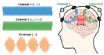 Temporal Interference Stimulation Devices: A Comprehensive Review of Hardware Design and Implementation